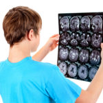 signs of concussion in a teen